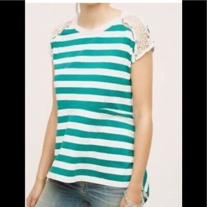 Little Yellow Button Striped Shirt